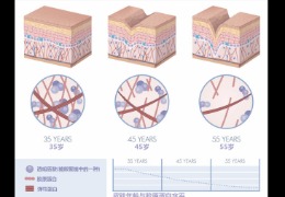 都在問的乙酰殼糖胺（NAG）功效怎么樣？功效成分的護(hù)膚品應(yīng)該怎么選？